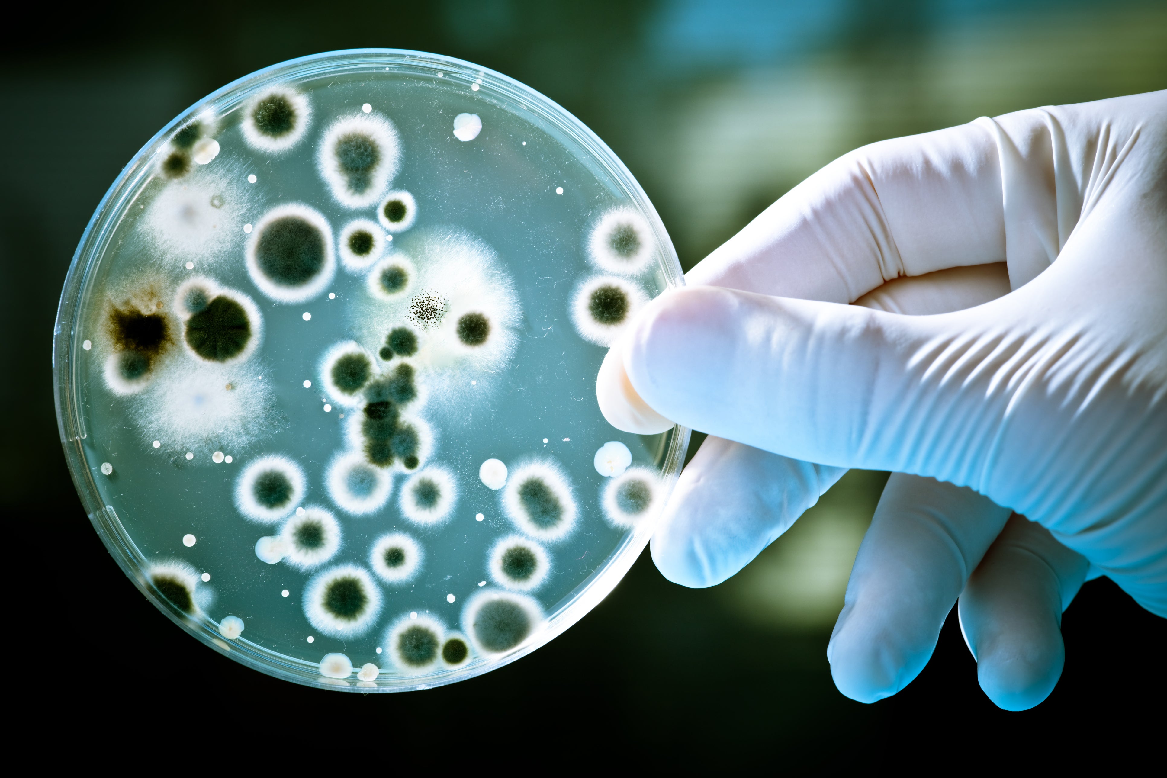 gloved hand holding biological sample in a petri dish (c) iStock