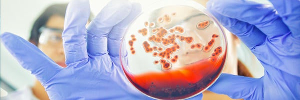 iStock Microbiology Lab Dish